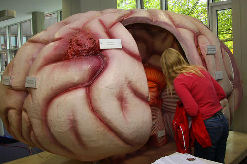 Auf Entdeckungstour durch das Gehirn konnten sich Besucher des Gesundheitstages vor den Hörsälen in der Rost- und Silberlaube machen.