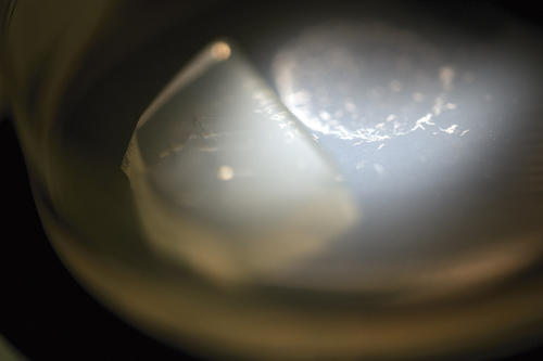 Nur knapp einen Millimeter klein, aber in der Forschung groß im kommen: Der Fadenwurm Caenorhabditis elegans.