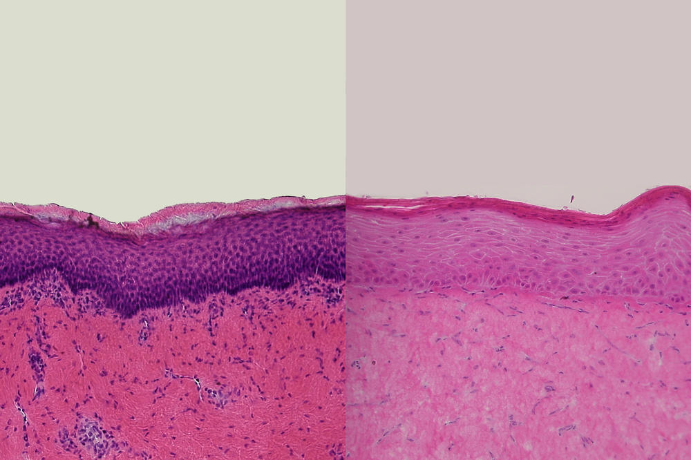 Die Querschnitte durch Humanhaut ex vivo (links) und durch rekonstruierte Humanhaut (rechts) zeigen große Ähnlichkeiten und sind Ausgangspunkt für die Nutzung von rekonstruierter Humanhaut in der Erforschung von Hautkrankheiten.